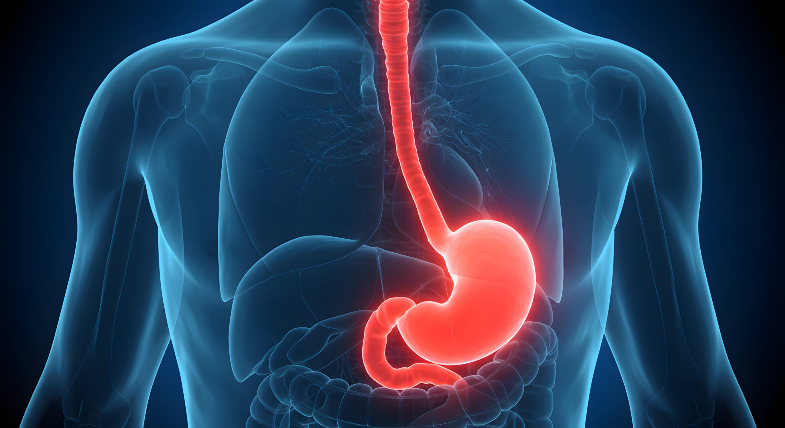 Digital illustration of a torso with digestive system, esophagus and stomach in red, on translucent chest and lungs; suggests inflammation.