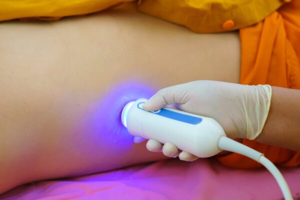 A gloved hand uses a white device emitting blue light on a person’s thigh, who wears orange clothing, suggesting cosmetic treatment.
